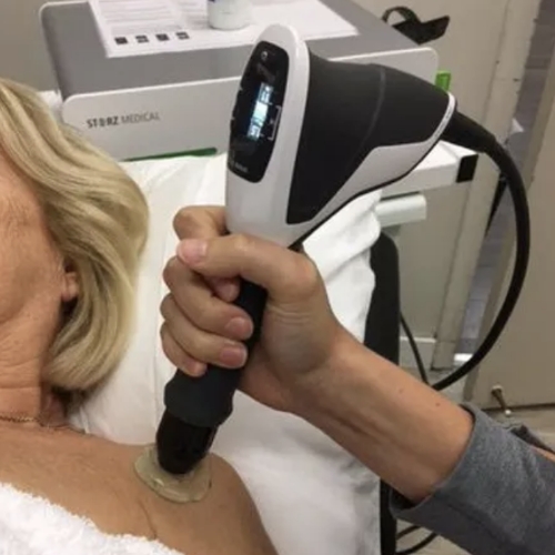 shockwave-therapy-Bloor-jane-physiotherapy-active-rehabilitation-toronto-on