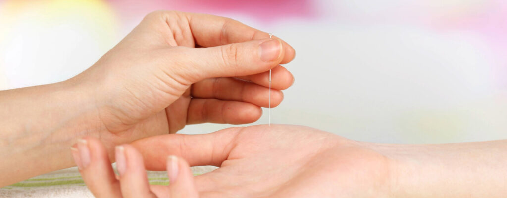 Using Acupuncture to Manage Arthritis Pain Effectively